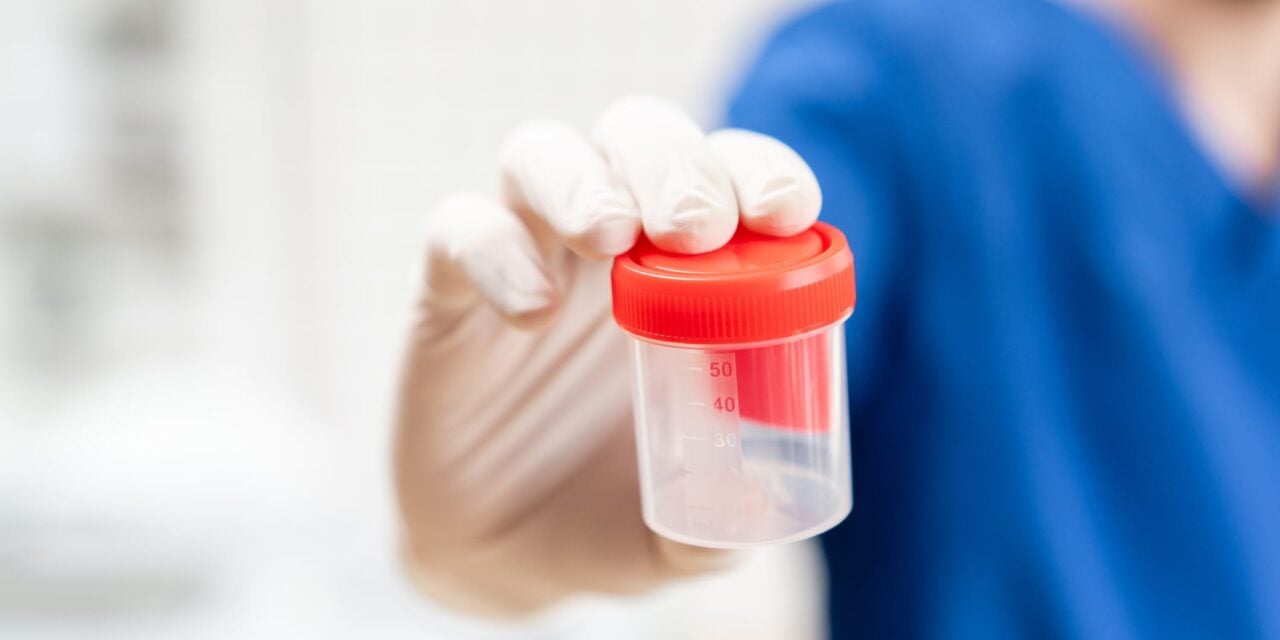Urine Drug Screens Miss Substances in Some Pediatric Samples