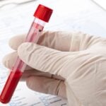 First FDA-Cleared Blood Test for Alzheimer’s Disease Launches