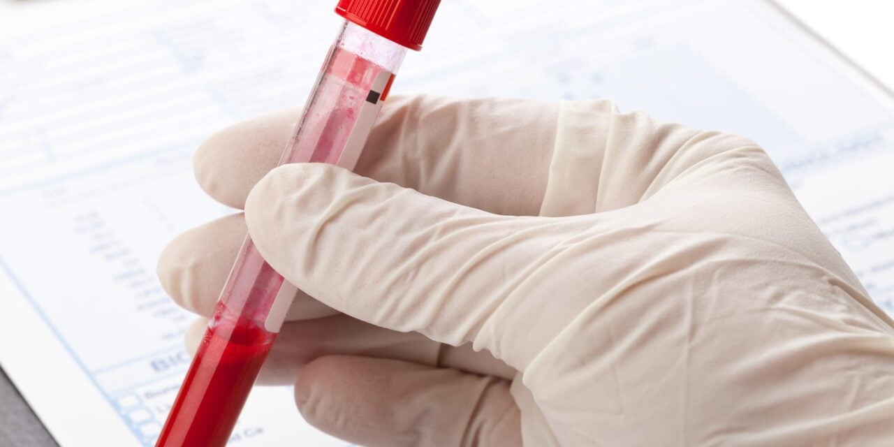 NeoGenomics Launches Blood-Based Genomic Profiling Test