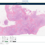 Digital Pathology Platform Delivers Immediate Efficiency Gains at P&C Labs