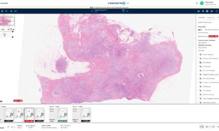 Digital Pathology Platform Delivers Immediate Efficiency Gains at P&C Labs