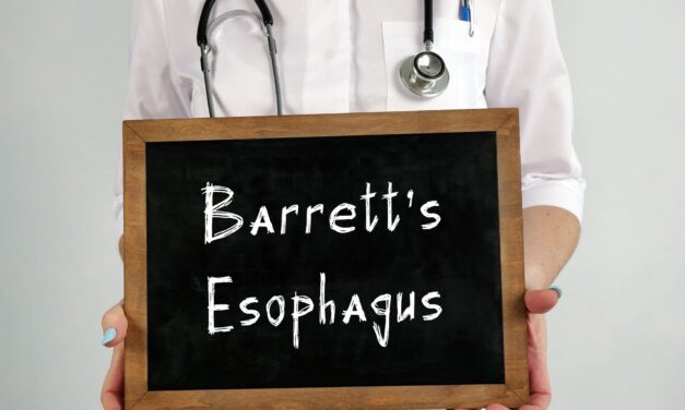 Barrett’s Esophagus Test Identifies High-Risk Patients Missed by Standard Pathology