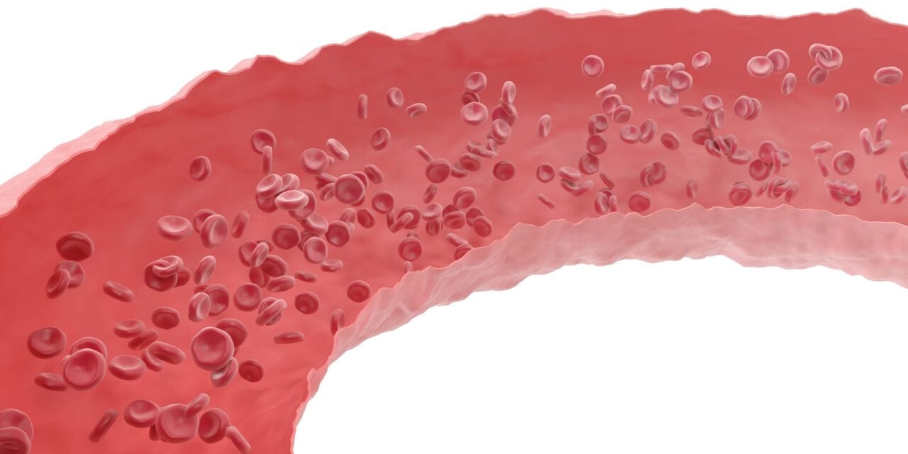 CoaguSense System Approved in Europe for Self-Monitoring of Oral Anticoagulation Therapy