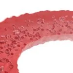 CoaguSense System Approved in Europe for Self-Monitoring of Oral Anticoagulation Therapy