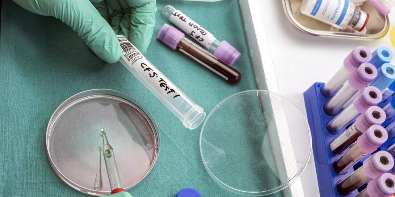 CLIA Accreditation Clears Path for CNSide Diagnostics’ CSF Assay Platform