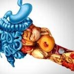 AI Companion Tool Idenfitied Food Triggers Based on IBS Sensitivity Testing