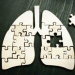 Circulating Tumor DNA Shows Promise for Guiding Immunotherapy in Lung Cancer