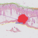 Proscia Expands AI Capabilities to Support Skin Pathology Evaluation