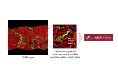 HistoIndex to Debut FibroSIGHT Plus for Liver Fibrosis Assessment at AASLD The Liver Meeting