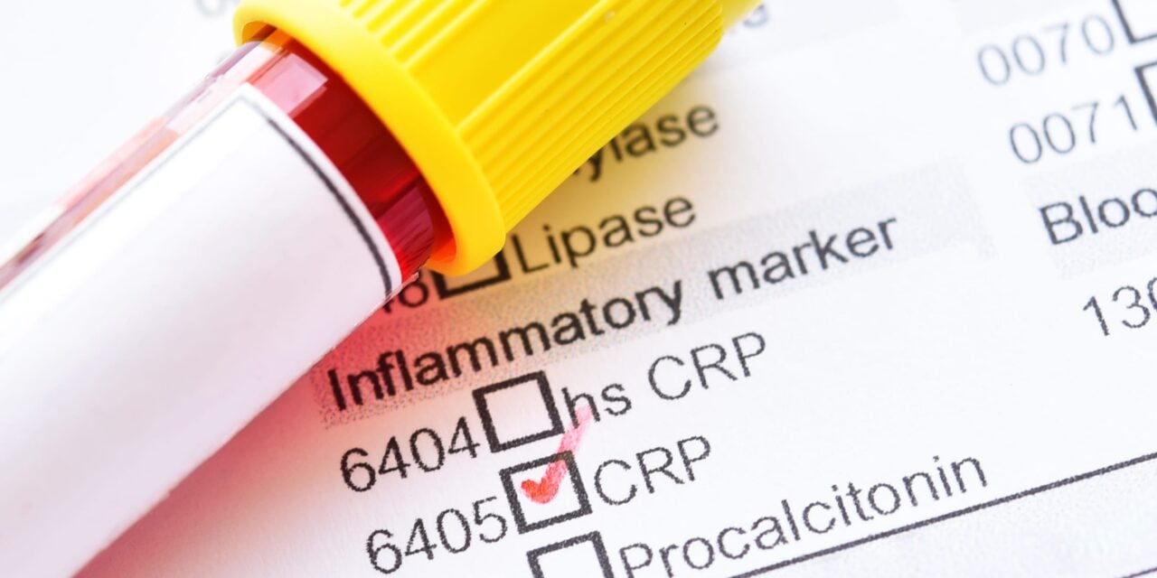 New AMP Report Template Aims to Simplify Molecular Biomarker Results