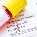 New AMP Report Template Aims to Simplify Molecular Biomarker Results