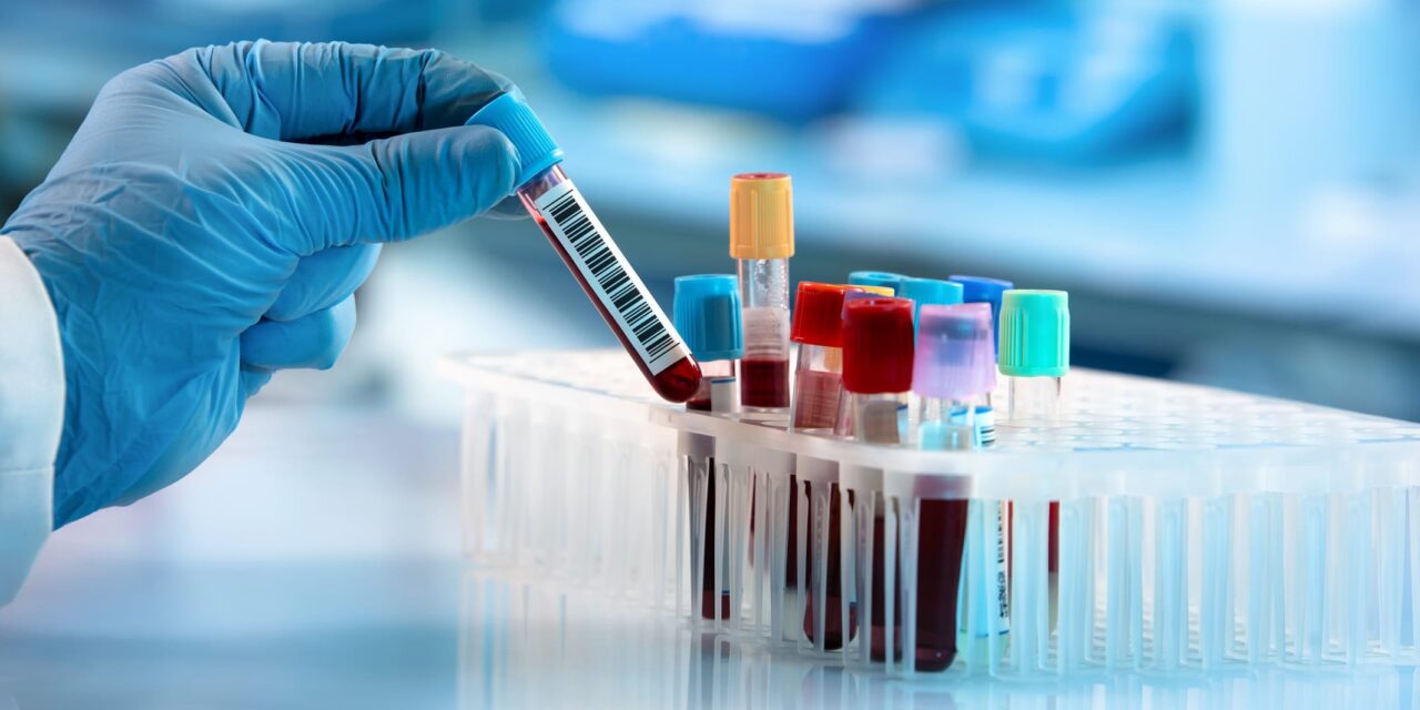 Can a New Blood Test Really Detect ME/CFS? An Expert Unpacks New Research