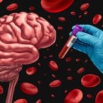 Study Demonstrates Accuracy of Two Quest Blood Tests for Alzheimer’s Diagnosis