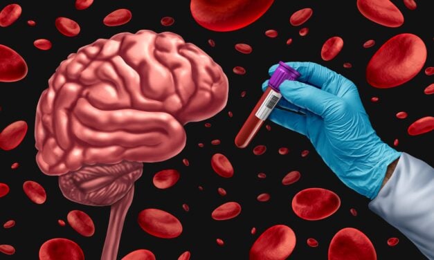 Study Demonstrates Accuracy of Two Quest Blood Tests for Alzheimer’s Diagnosis