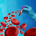 AI-Powered Blood Test Shows Promise for Early Lung Cancer Detection