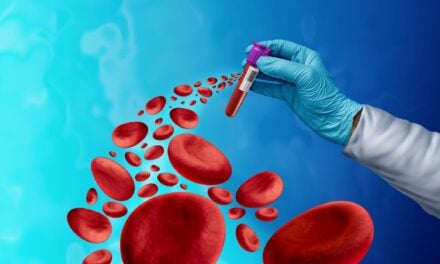 AI-Powered Blood Test Shows Promise for Early Lung Cancer Detection