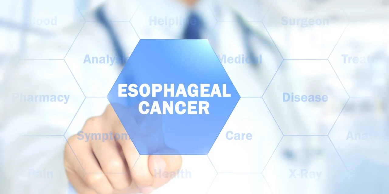 Study Validating Esophageal Cancer Test Accepted by Gastroenterology Journal