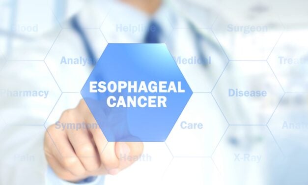 Study Validating Esophageal Cancer Test Accepted by Gastroenterology Journal