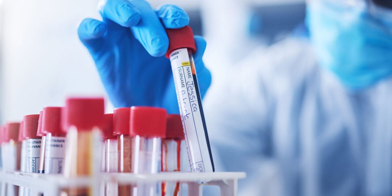 Why Your Sample Management System May Be Slowing Discovery