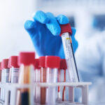 Why Your Sample Management System May Be Slowing Discovery