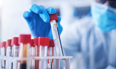 Why Your Sample Management System May Be Slowing Discovery