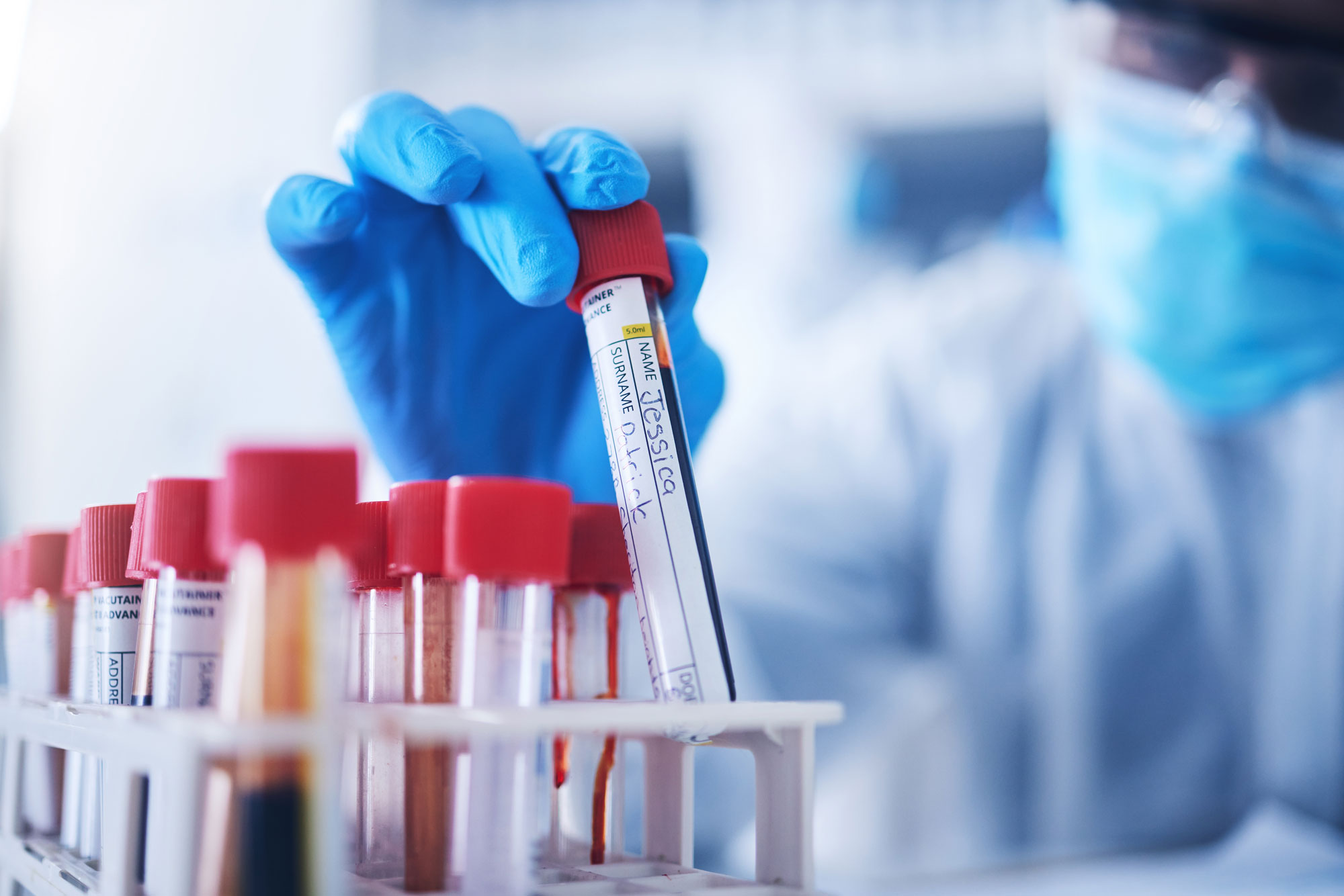 Why Your Sample Management System May Be Slowing Discovery | Clinical ...