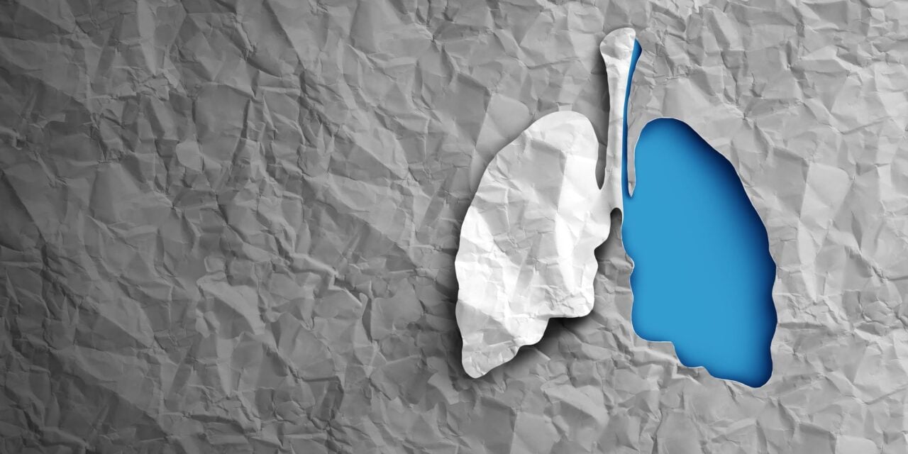 Thermo Fisher Launches Molecular Diagnostic System for Lung Transplant Rejection Assessment