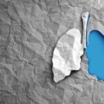 Thermo Fisher Launches Molecular Diagnostic System for Lung Transplant Rejection Assessment