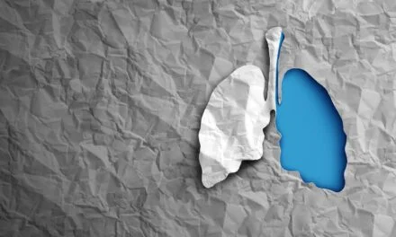 Thermo Fisher Launches Molecular Diagnostic System for Lung Transplant Rejection Assessment
