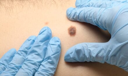 Large Melanoma Trial Validates Gene Expression Test’s Predictive Accuracy