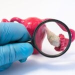 Blood Test Shows High Accuracy for Early Ovarian Cancer Detection