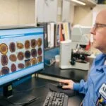 AI System Outperforms Human Detection of Parasites in Stool Samples