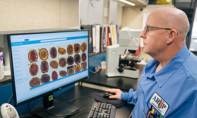 AI System Outperforms Human Detection of Parasites in Stool Samples