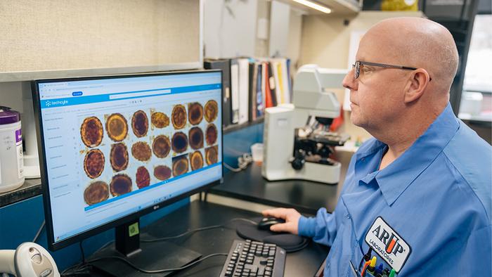 AI System Outperforms Human Detection of Parasites in Stool Samples