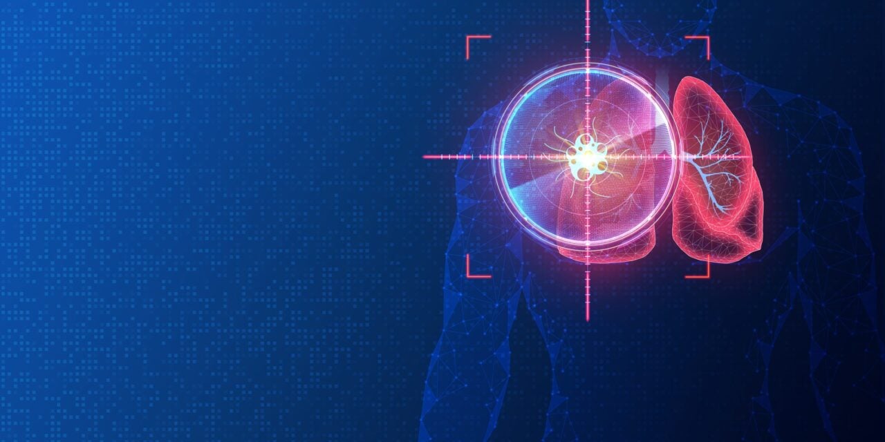 Circulogene Launches Tissue-Based Genomic Profiling Assay for Solid Tumors