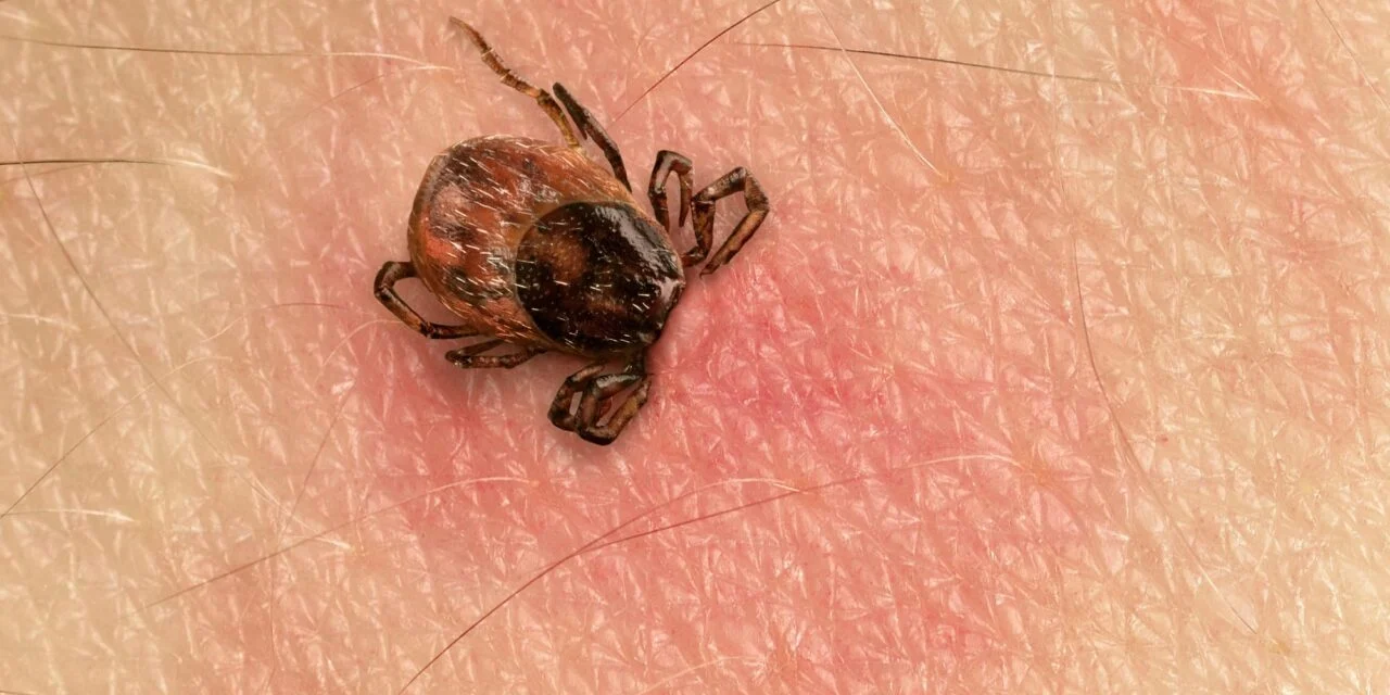 Novel Single-Tier Lyme Disease Tests Show Superior Early Detection