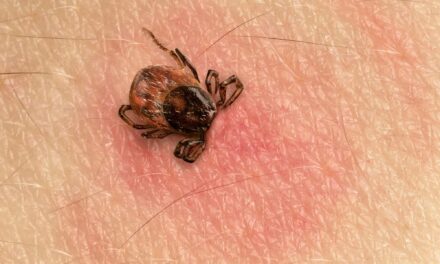Novel Single-Tier Lyme Disease Tests Show Superior Early Detection