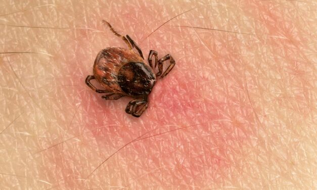 Novel Single-Tier Lyme Disease Tests Show Superior Early Detection