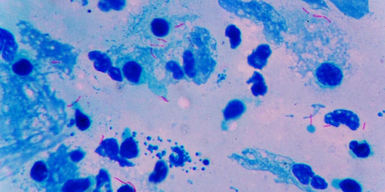 Co-Diagnostics Develops Sample Prep Instrument for Point-of-Care Tuberculosis Testing