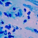 Co-Diagnostics Develops Sample Prep Instrument for Point-of-Care Tuberculosis Testing