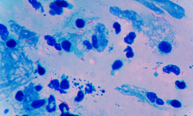 Co-Diagnostics Develops Sample Prep Instrument for Point-of-Care Tuberculosis Testing