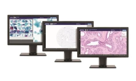Hologic Gains Expanded CE Marking for Digital Pathology System