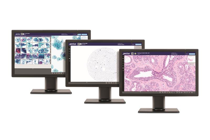 Hologic Gains Expanded CE Marking for Digital Pathology System