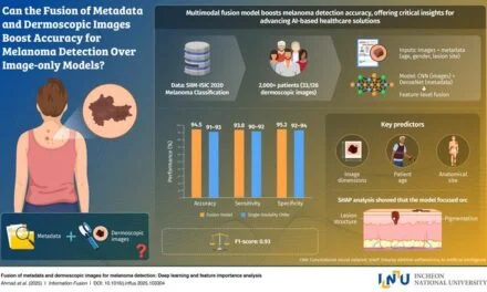 AI Model Achieves 94.5% Accuracy in Melanoma Detection Using Combined Data Sources