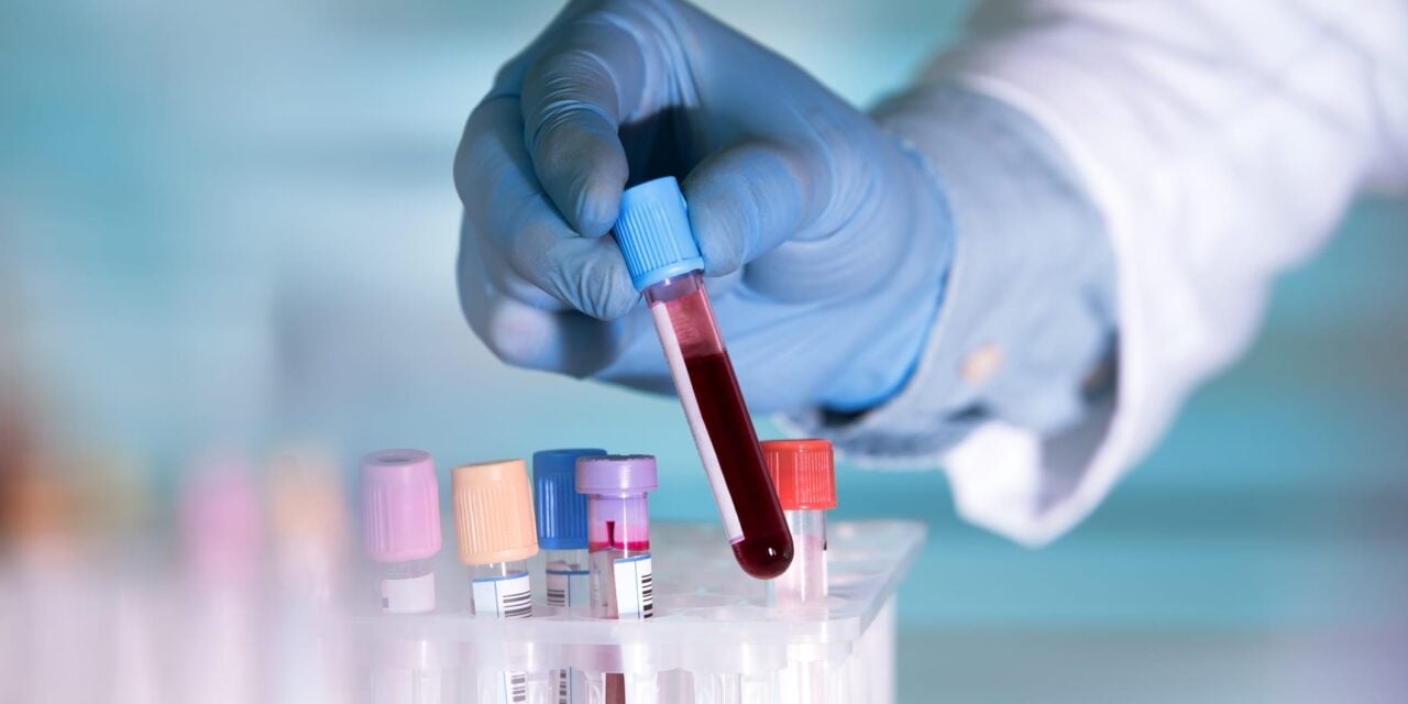 Multi-Cancer Blood Test Could Significantly Reduce Late-Stage Diagnoses
