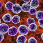 New Kitted NGS Panel Launches Targeting Lymphoid Malignancies