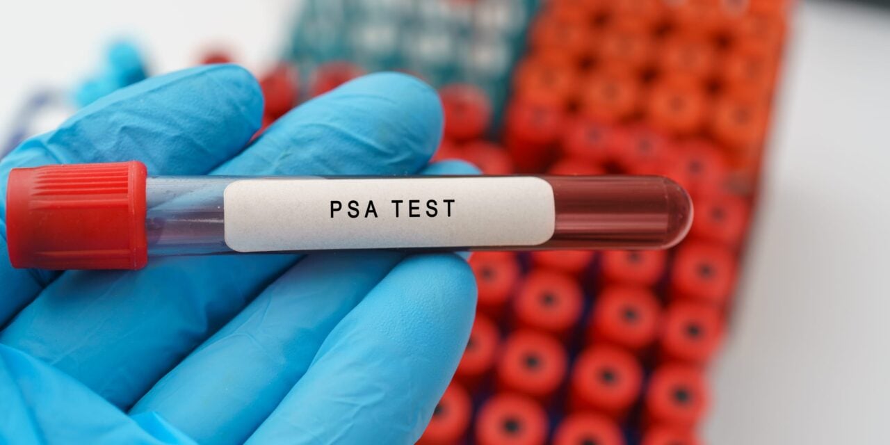 PSA Screening Shows Sustained Prostate Cancer Mortality Reduction in 23-Year Study