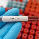 PSA Screening Shows Sustained Prostate Cancer Mortality Reduction in 23-Year Study