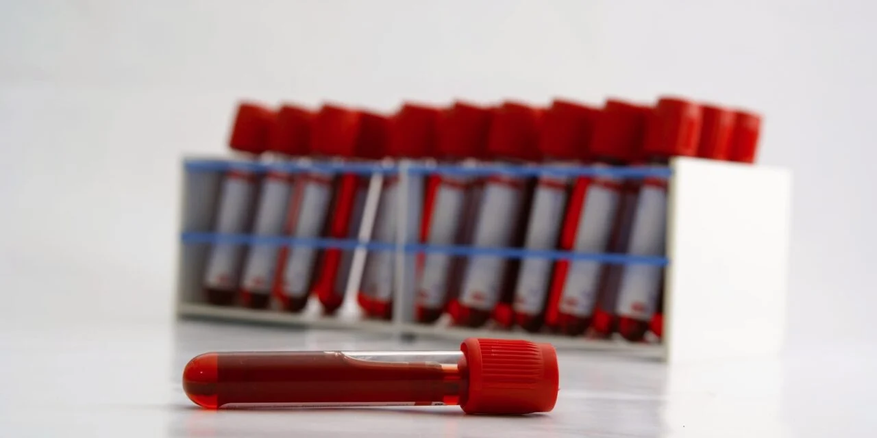 Lab Validates FDA-Cleared Blood-Based Alzheimer’s Biomarker Assay Under EU Regulations