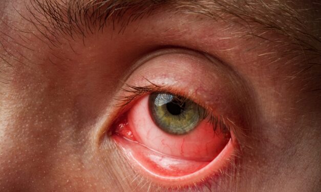 Tear-Based Diagnostic Test for Red Eye Conditions Enters Clinical Study